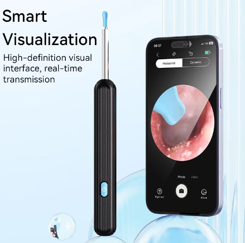 Smart Ear Wax Removal Kit β Visual Camera Cleaner for Effective Ear Care