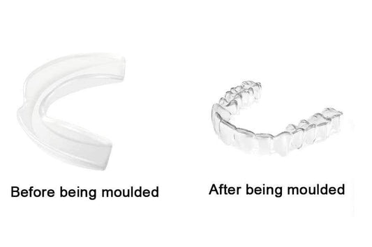 Pack of 4 Professional Dental Night Guards for Teeth Grinding Teeth Protector for Night time Grinding