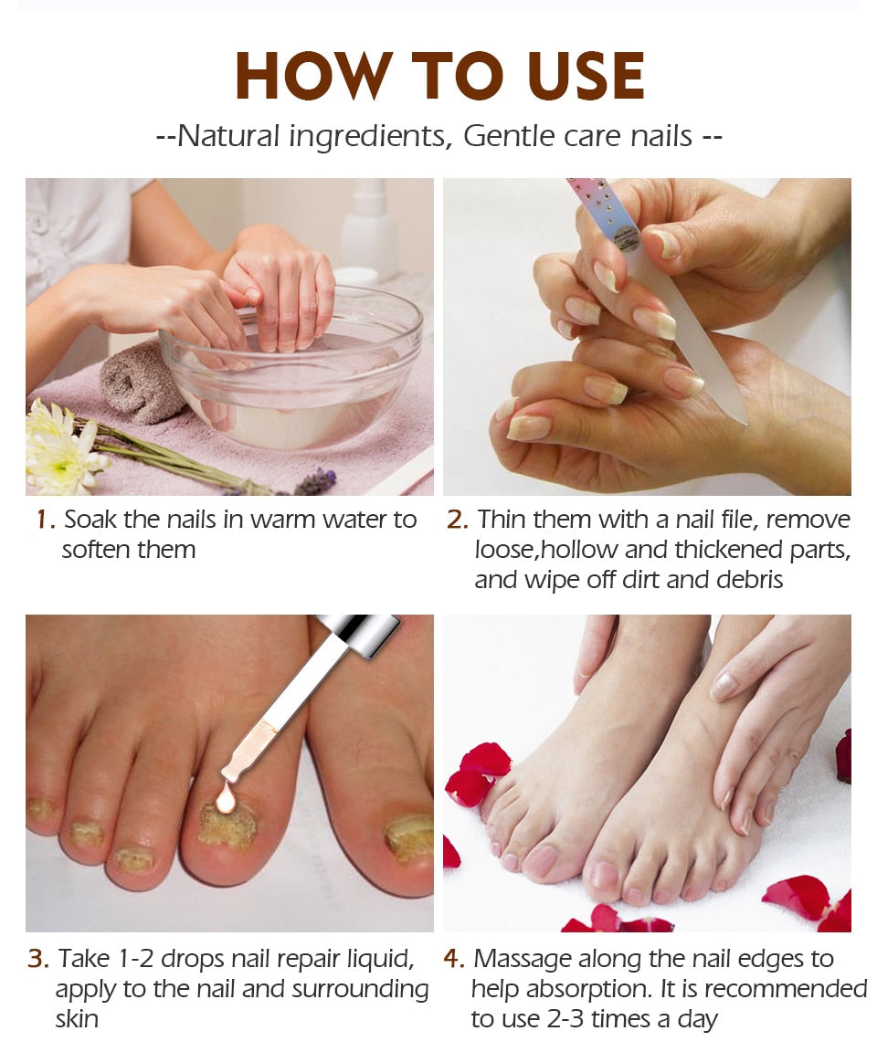 Fingernail fungus - Fungal Nail Treatment - Toenail Fungus