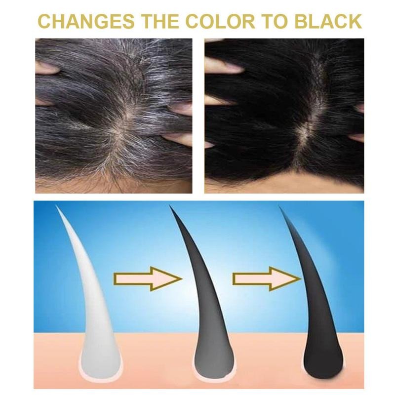 Shampoo for Men's Thinning Hair, Shedding Hair