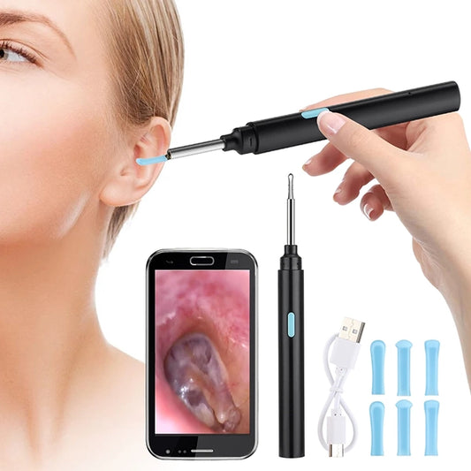 Smart Ear Wax Removal Kit – Visual Camera Cleaner for Effective Ear Care