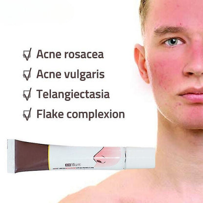 K - Rosacea formula best rosacea treatment