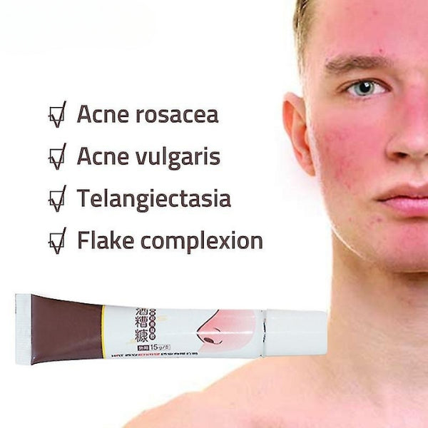 K - Rosacea formula best rosacea treatment