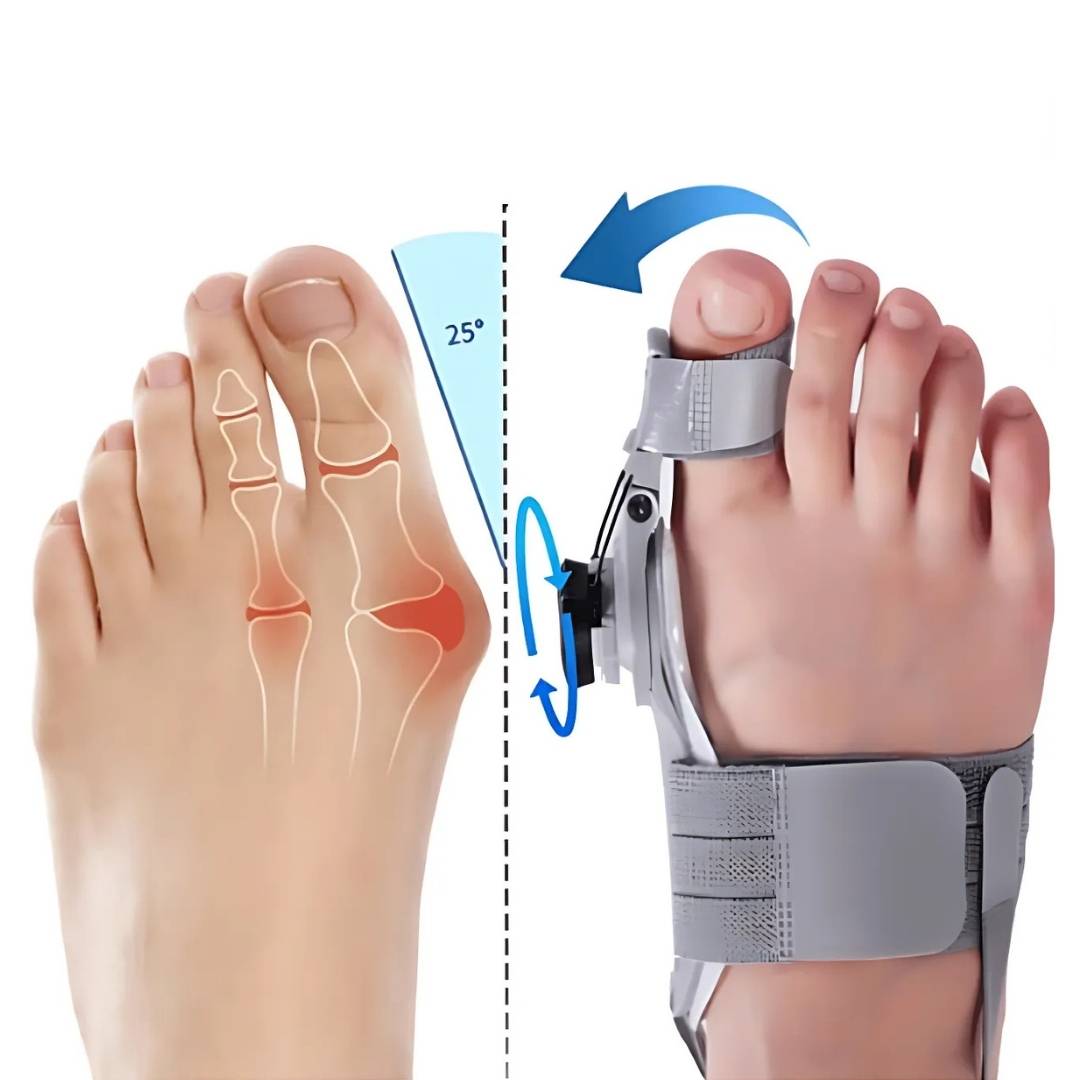 Adjustable Bunion Relief Brace for Hallux Valgus - Corrects and Alleviates Pain from Bunions