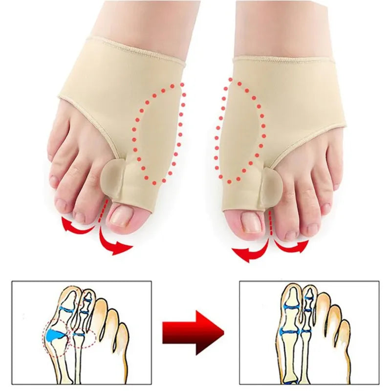 Bunion Corrector & Toe Separator 2 Pcs