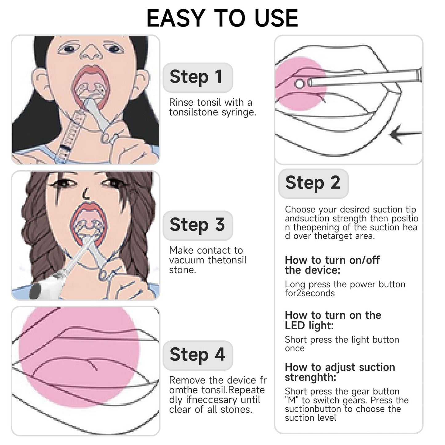 Tonsil Stone Removal Kit with Irrigation Syringe – Effective Tool for Tonsilith Extraction