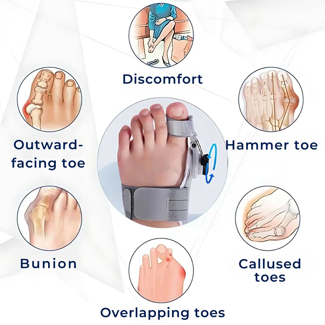 Adjustable Bunion Relief Brace for Hallux Valgus - Corrects and Alleviates Pain from Bunions