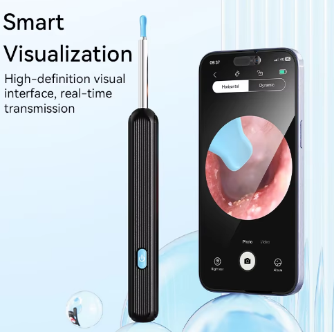 Smart Ear Wax Removal Kit – Visual Camera Cleaner for Effective Ear Care