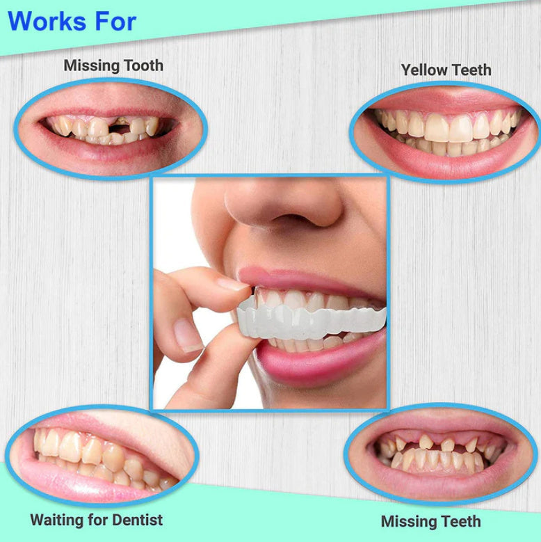 Clip On Teeth Veneers - Instant Smile with Fake Teeth Dentures