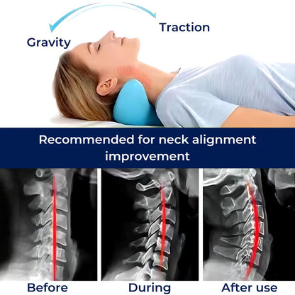 Chiropractic Neck Pillow for Pain Relief and Improved Posture - Neck Stretcher for Better Sleep and Comfort