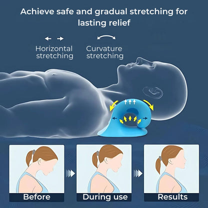 Chiropractic Neck Pillow for Pain Relief and Improved Posture - Neck Stretcher for Better Sleep and Comfort