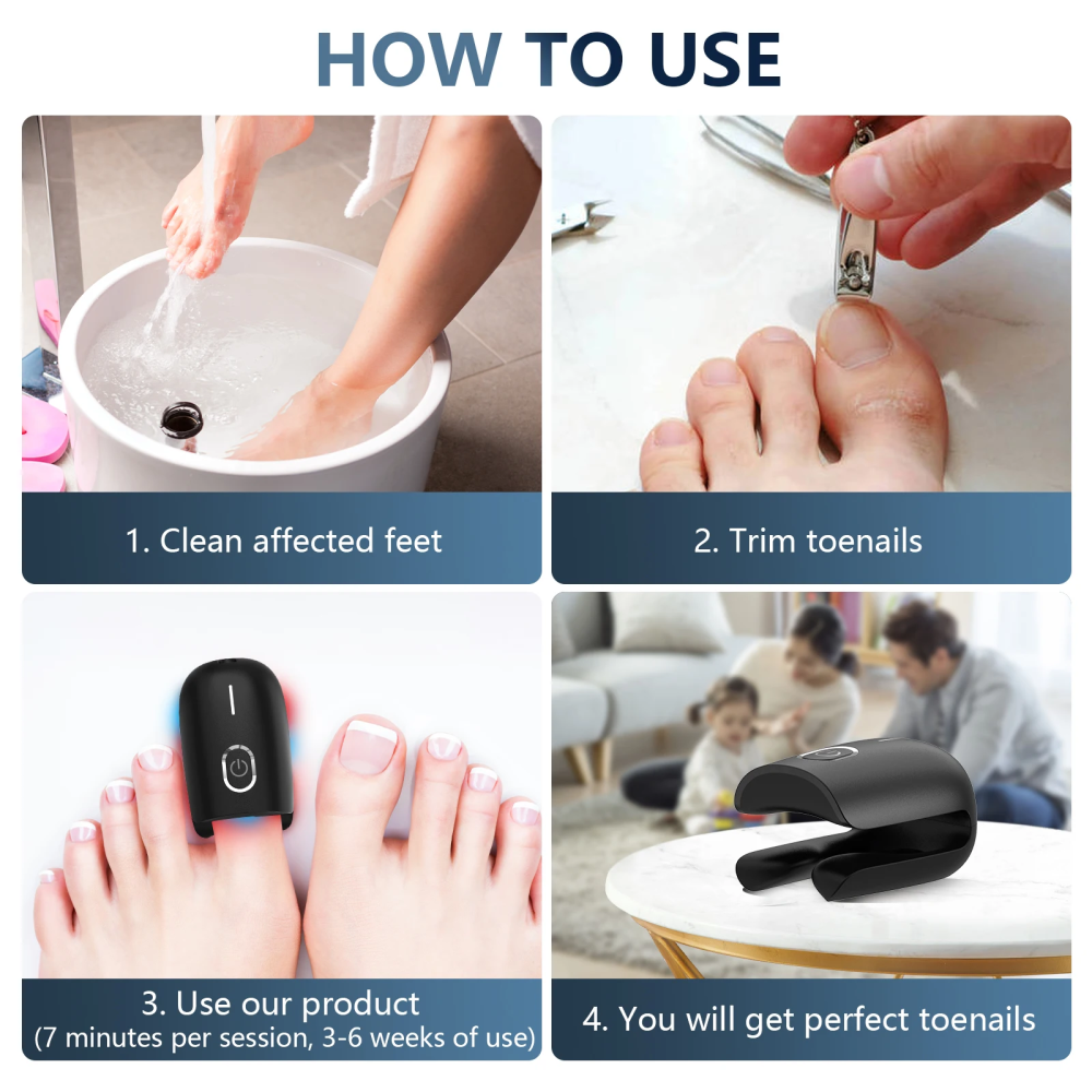 Laser Heal Toenail Fungus Removal Laser