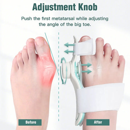 Epitact Bunion Corrector - Effective Strapping for Bunion Help and Correction Treatmen Home