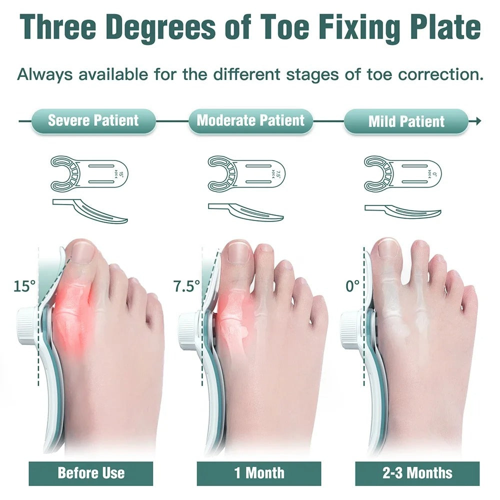 Epitact Bunion Corrector - Effective Strapping for Bunion Help and Correction Treatmen Home