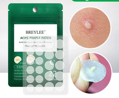 Skin Tag Patch - Hygienic & Mess Free Natural Skin Tag Aid - Acne Patch