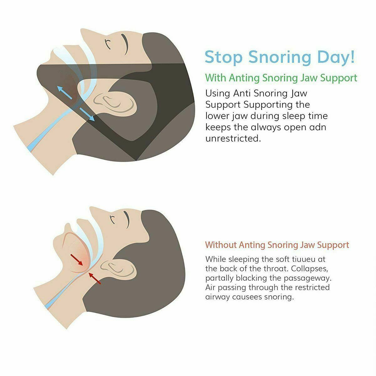 Anti-Snoring Chin Strap