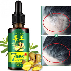 Hair Regrow Oil | 7 Day Hair Regrowth Ginger Serum