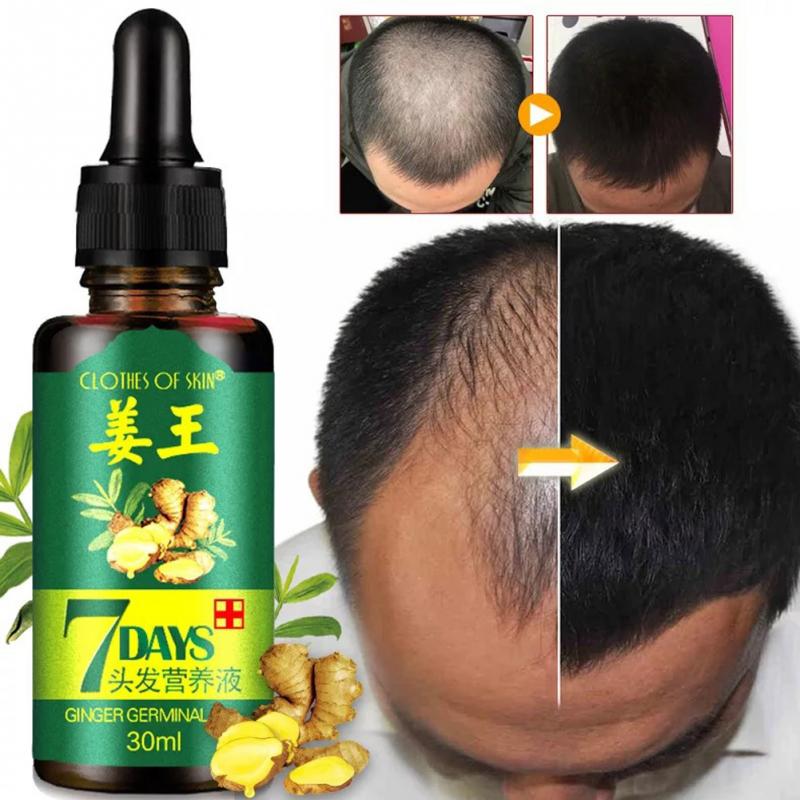 Hair Regrow Oil | 7 Day Hair Regrowth Ginger Serum