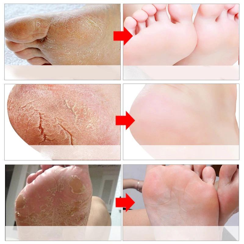 Original Baby Foot Peel Exfoliating Mask